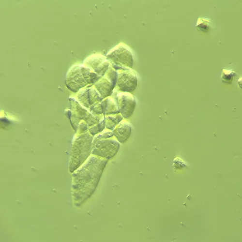 picture MAGUS HCM360 Device for working with the Hoffman modulation contrast, with objective set,  14