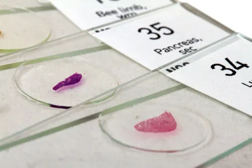 photo Levenhuk N80 NG "See it all" Slides Set,  6