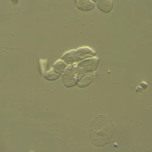 picture MAGUS HCM360 Device for working with the Hoffman modulation contrast, with objective set,  13